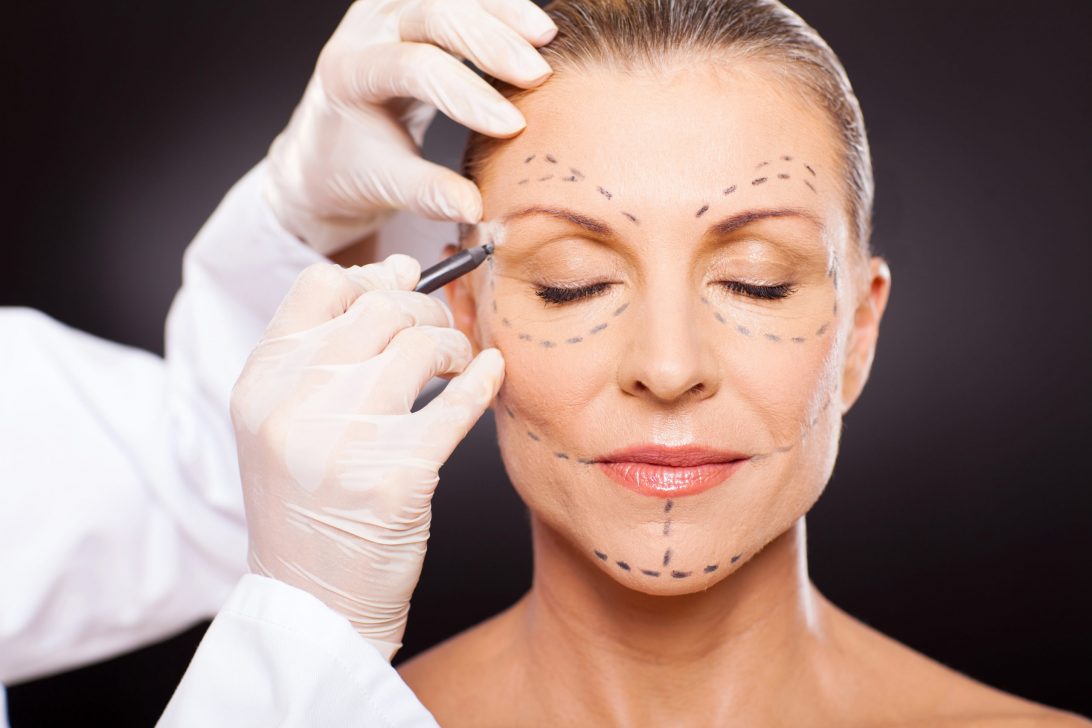 Lifting facial, a cirurgia para flacidez e rugas no rosto