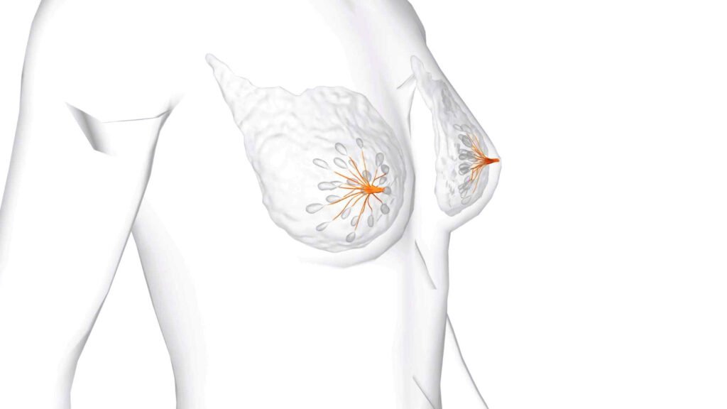 Simulação 3D cirurgia de Mama
