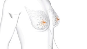 Simulação 3D cirurgia de Mama