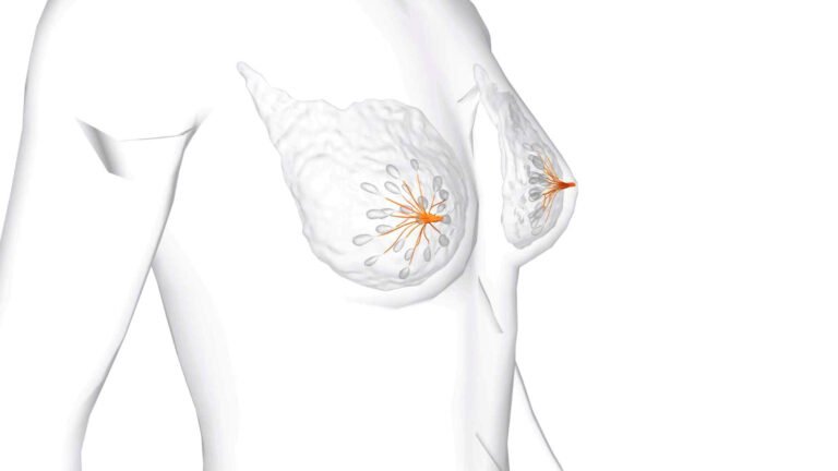 Simulação 3D cirurgia de Mama