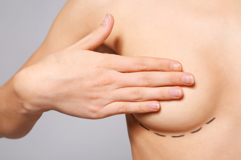 Cicatriz da cirurgia de mama: como ela evolui ao longo do tempo?