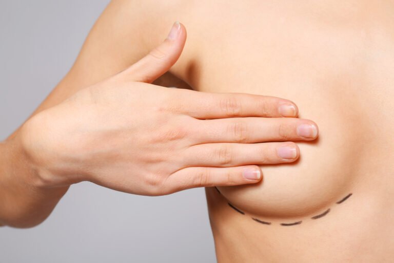 Cicatriz da cirurgia de mama: como ela evolui ao longo do tempo?